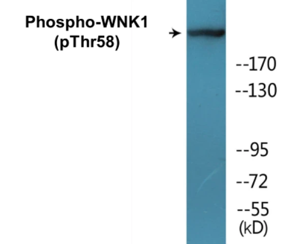 WNK1 (phospho Thr58) Cell Based ELISA Kit (A102415-296)