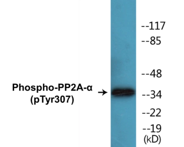 PP2A alpha (phospho Tyr307) Cell Based ELISA Kit (A102512-296)