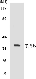 TISB Cell Based ELISA Kit (A103259-96)