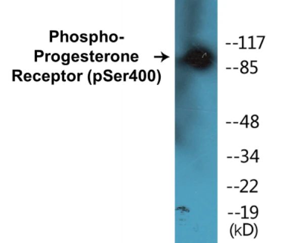 Progesterone Receptor (phospho Ser400) Cell Based ELISA Kit (A102748-296)