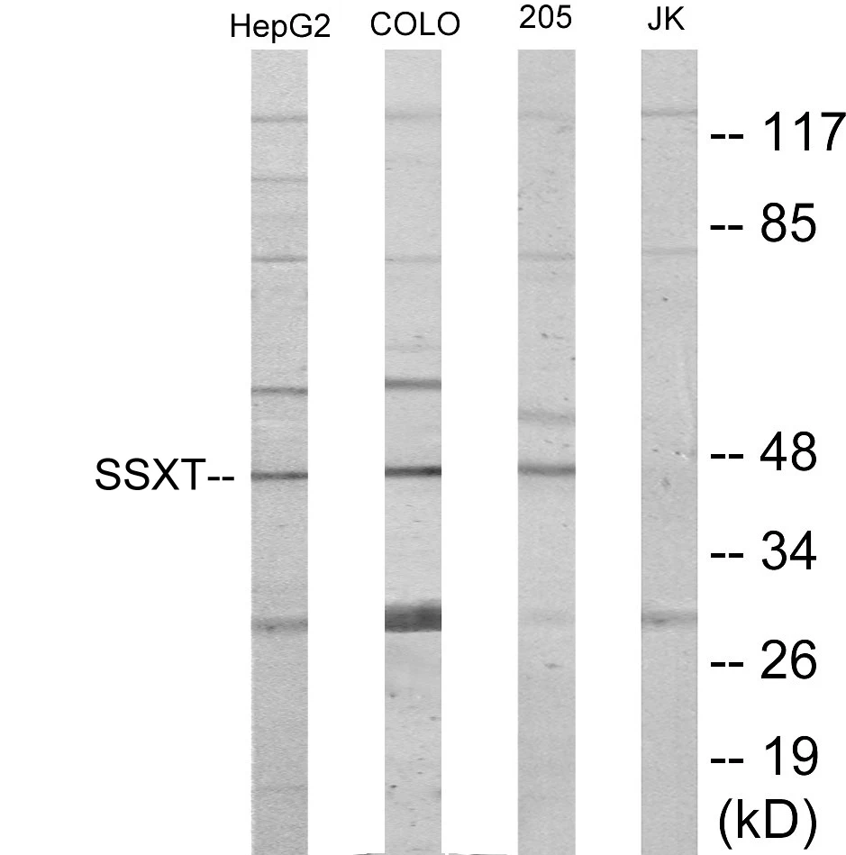 SSXT Cell Based ELISA Kit (A103295-96)