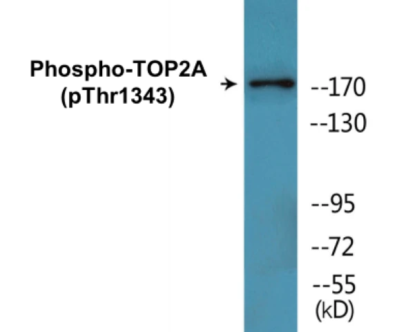 TOP2A (phospho Thr1343) Cell Based ELISA Kit (A102711-296)