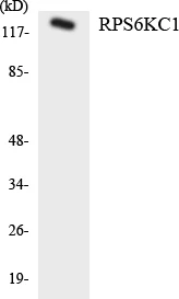 RPS6KC1 Cell Based ELISA Kit (A103406-96)