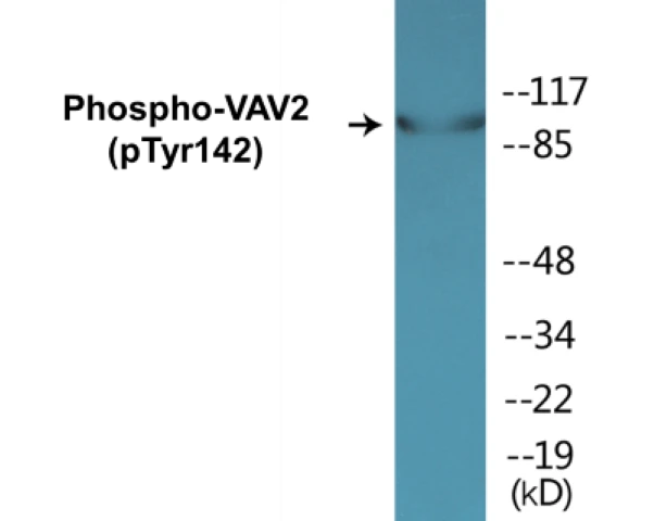 VAV2 (phospho Tyr142) Cell Based ELISA Kit (A102640-296)