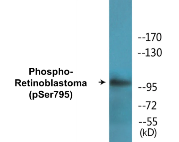 Retinoblastoma (phospho Ser795) Cell Based ELISA Kit (A102378-296)