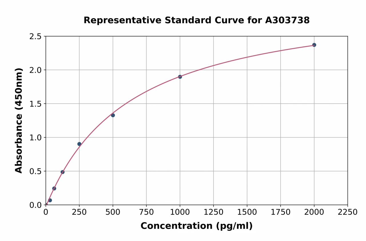 Rat SGK1 ELISA Kit (A303738-96)