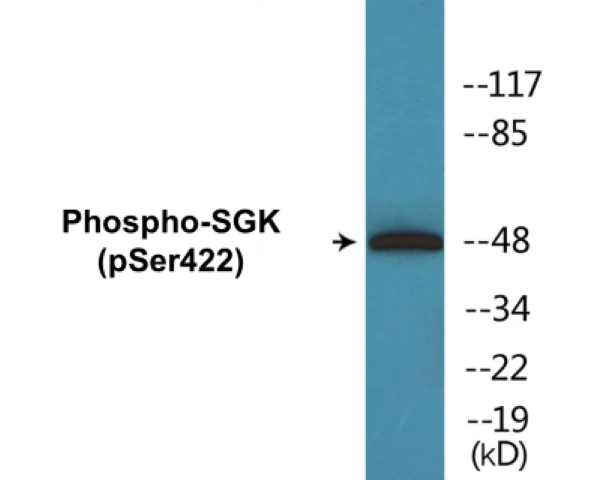 SGK (phospho Ser422) Cell Based ELISA Kit (A102396-296)