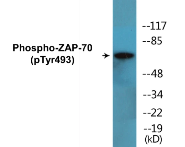 ZAP-70 (phospho Tyr493) Cell Based ELISA Kit (A102107-296)