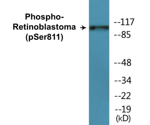 Retinoblastoma (phospho Ser811) Cell Based ELISA Kit (A102370-296)