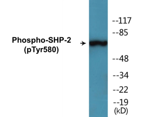 SHP-2 (phospho Tyr580) Cell Based ELISA Kit (A103804-296)