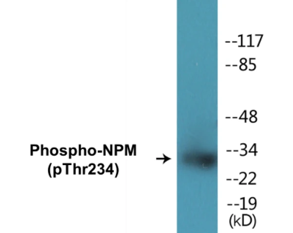 NPM (phospho Thr234) Cell Based ELISA Kit (A102432-296)