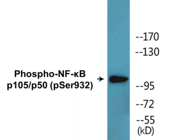 NF-kB p105 / p50 (phospho Ser932) Cell Based ELISA Kit (A102118-296)