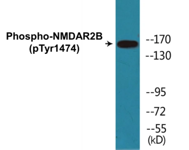 NMDAR2B (phospho Tyr1474) Cell Based ELISA Kit (A102578-296)