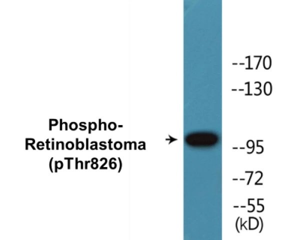 Retinoblastoma (phospho Thr826) Cell Based ELISA Kit (A102377-296)