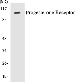 Progesterone Receptor Cell Based ELISA Kit (A103592-96)