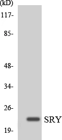 SRY Cell Based ELISA Kit (A103753-96)