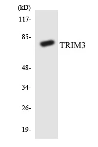 TRIM3 Cell Based ELISA Kit (A103134-96)