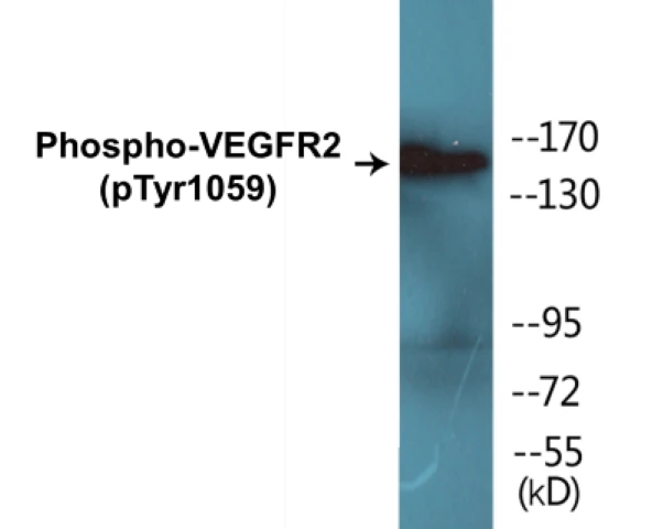 VEGFR2 (phospho Tyr1059) Cell Based ELISA Kit (A103777-296)