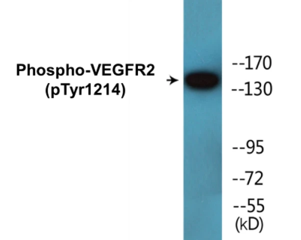 VEGFR2 (phospho Tyr1214) Cell Based ELISA Kit (A102048-296)