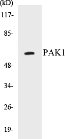 PAK1 Cell Based ELISA Kit (A103187-96)