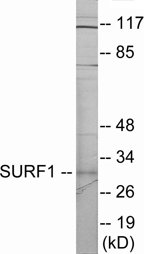 SURF1 Cell Based ELISA Kit (A103167-96)