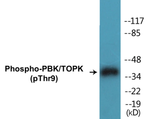 PBK (phospho Thr9) Cell Based ELISA Kit (A102769-296)