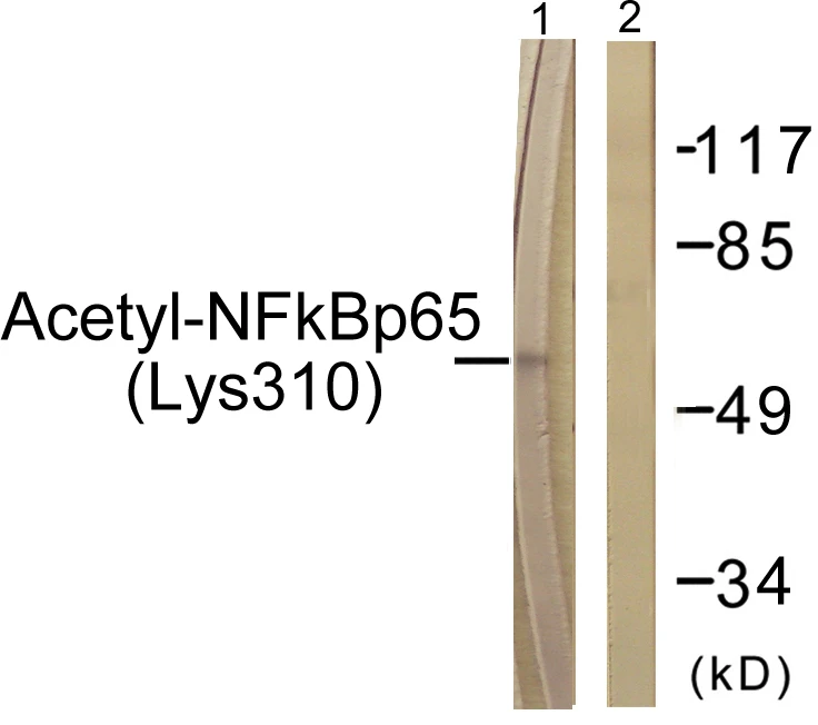 NF-kappaB p65 (acetyl Lys310) Cell Based ELISA Kit (A103764-296)