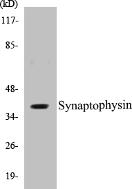 Synaptophysin Cell Based ELISA Kit (A102839-96)