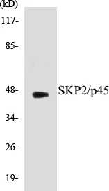 SKP2 Cell Based ELISA Kit (A103728-96)