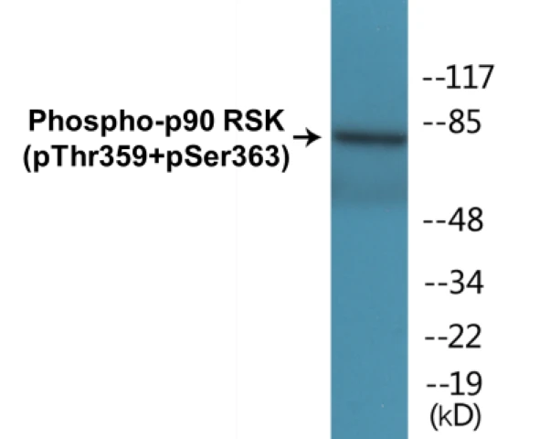 p90RSK (phospho Thr359 + Ser363) Cell Based ELISA Kit (A102237-296)