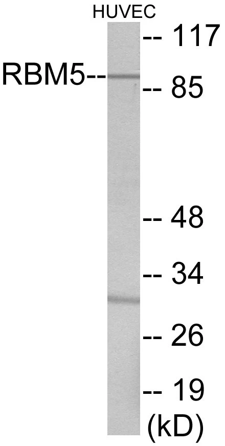 RBM5 Cell Based ELISA Kit (A103543-96)