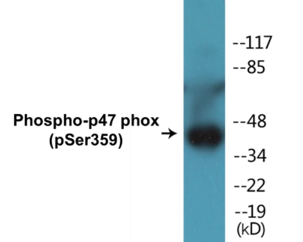 p47phox (phospho Ser359) Cell Based ELISA Kit (A102704-296)