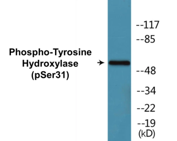 Tyrosine Hydroxylase (phospho Ser31) Cell Based ELISA Kit (A103759-296)