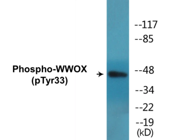 WWOX (phospho Tyr33) Cell Based ELISA Kit (A102674-296)