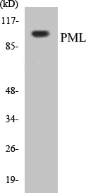 PML Cell Based ELISA Kit (A103748-96)