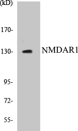 NMDAR1 Cell Based ELISA Kit (A103011-96)