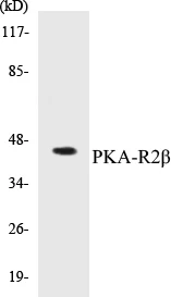 PKA-R2 beta Cell Based ELISA Kit (A102865-96)