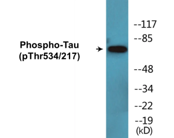 Tau (phospho Thr534 + Thr217) Cell Based ELISA Kit (A102495-296)