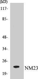 NM23 Cell Based ELISA Kit (A103197-96)