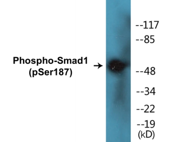 Smad1 (phospho Ser187) Cell Based ELISA Kit (A102621-296)