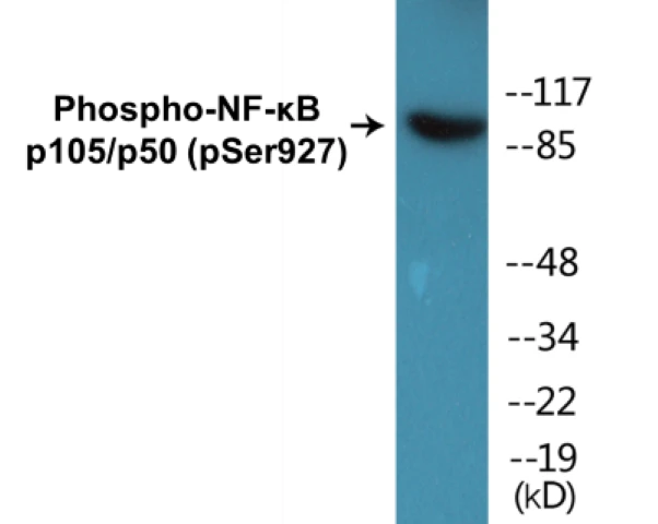 NF-kB p105 / p50 (phospho Ser927) Cell Based ELISA Kit (A102605-296)