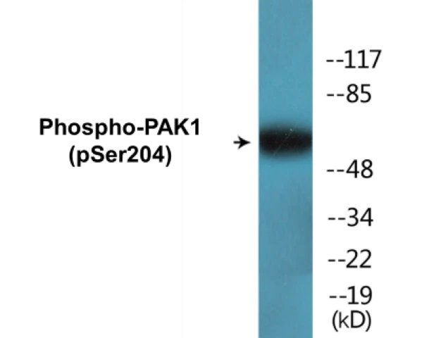 PAK1 (phospho Ser204) Cell Based ELISA Kit (A102267-296)