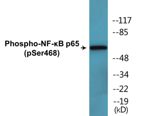 NF-kB p65 (phospho Ser468) Cell Based ELISA Kit (A102556-296)