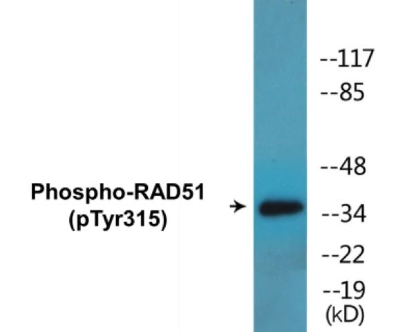 RAD51 (phospho Tyr315) Cell Based ELISA Kit (A102625-296)