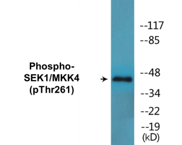 SEK1 (phospho Thr261) Cell Based ELISA Kit (A102258-296)