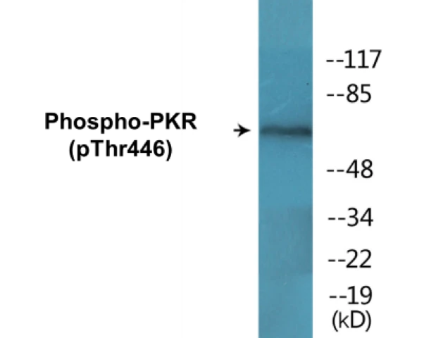 PKR (phospho Thr446) Cell Based ELISA Kit (A102750-296)