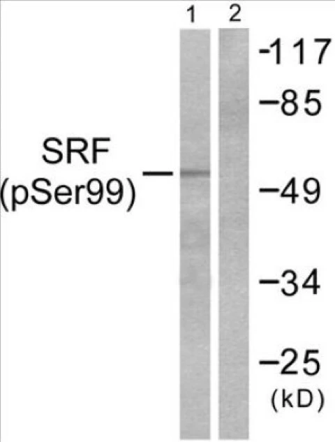 SRF (phospho Ser99) Cell Based ELISA Kit (A102470-296)