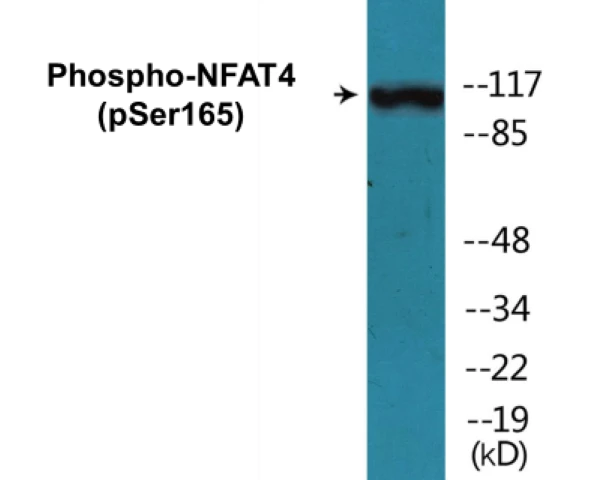 NFAT4 (phospho Ser165) Cell Based ELISA Kit (A102617-296)