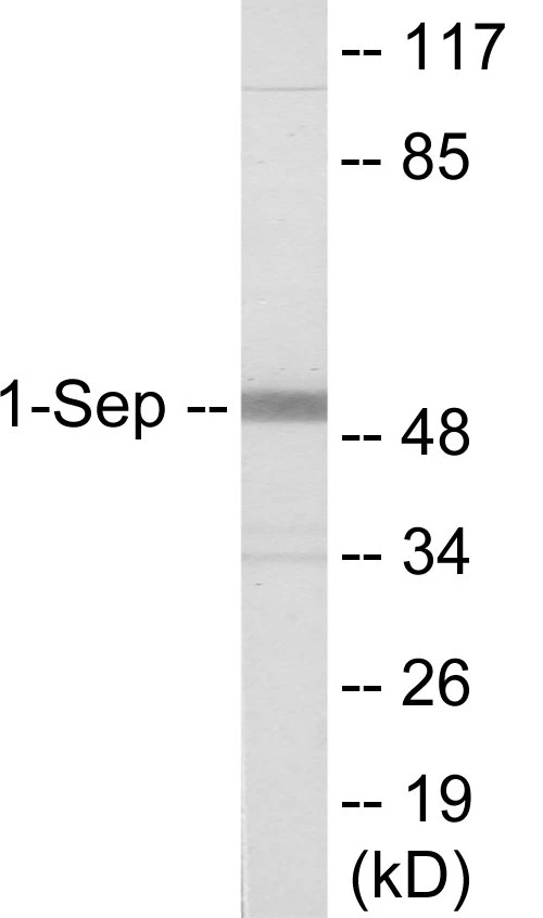 SEPT1 Cell Based ELISA Kit (A103172-96)