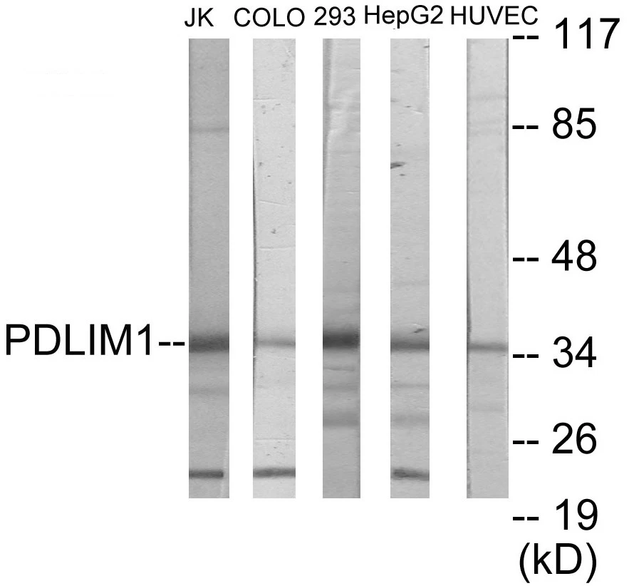 PDLIM1 Cell Based ELISA Kit (A103016-96)